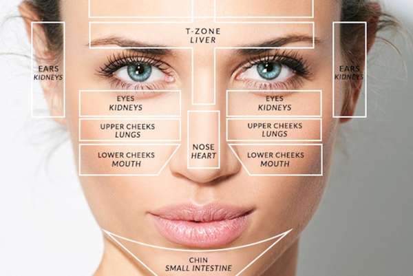 vị trí mụn trên khuôn mặt 